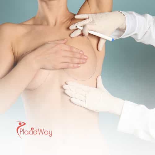 Is Breast Augmentation in Thailand Safe for New Zealanders? Here’s What You Should Know